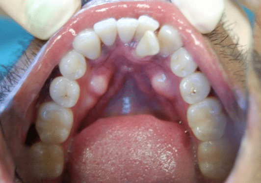 Smile Gallery. Dentist in Laguna Hills, CA. Dr. Marian Bradford, DDS. Premier Dental of South Orange County